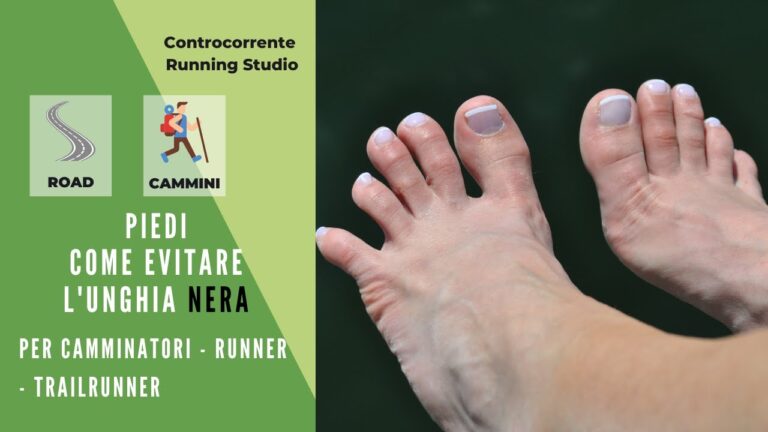 Camminata estrema? Scopri il segreto delle unghie nere e come proteggerle